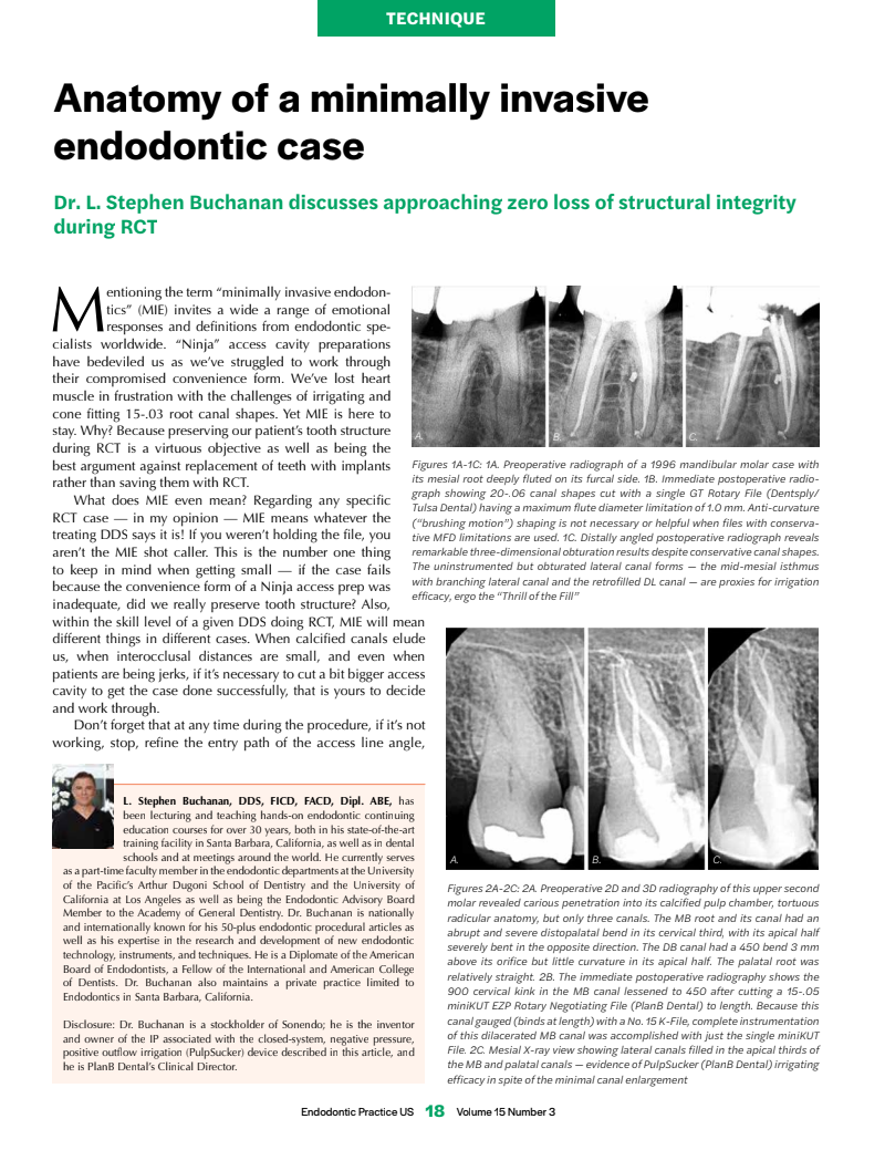 Buchanan MIE Article - Endodontic Practice, Fall 2022